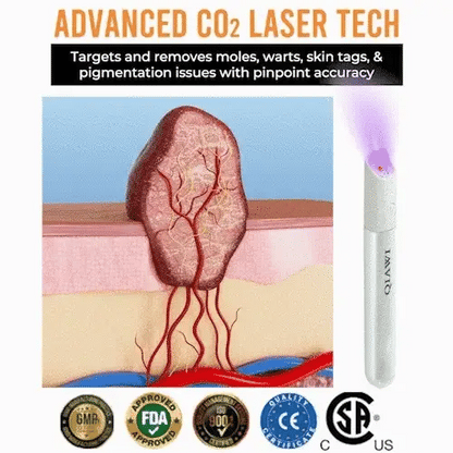 Instant Flawless Skin Laser Pen for Mole and Wart Removal