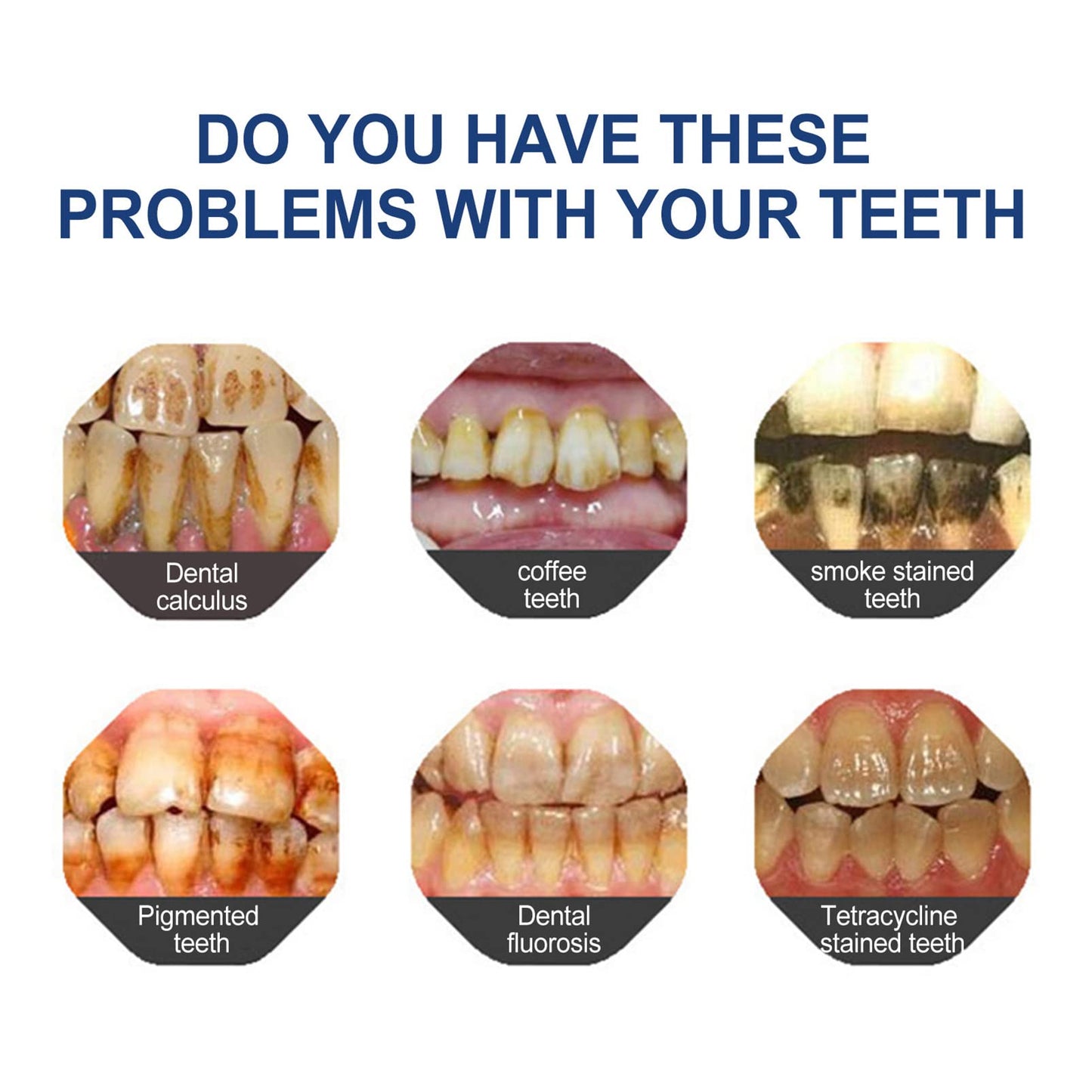 🔥 Final Day 60% OFF 🔥BBOJI™- Fluoride-Free Hydroxyapatite Toothpaste